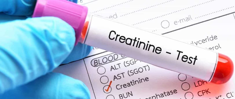 Üre ve Kreatinin Nedir? Böbrek Fonksiyon Testleri ve Anlamları