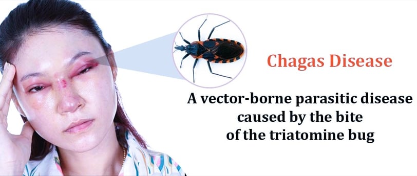 Chagas Disease