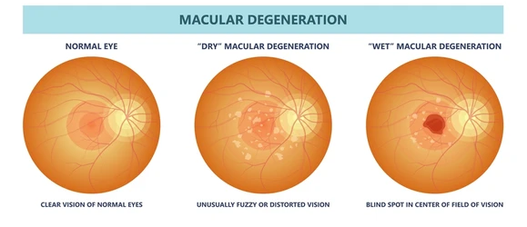 macula