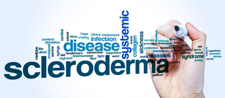 scleroderma