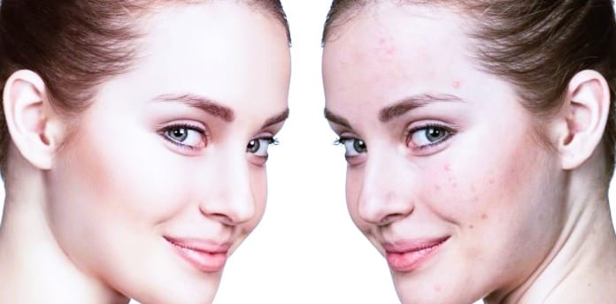 Winter Skin Care