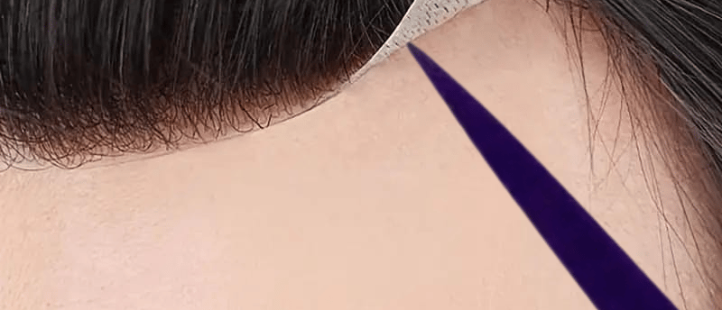 Wig tape safe removal