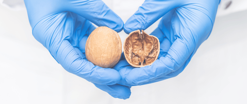 negligencia por no diagnosticar torsión testicular