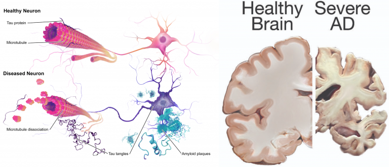 https://wtcs.pressbooks.pub/app/uploads/sites/31/2021/02/brain-health-768x331.png