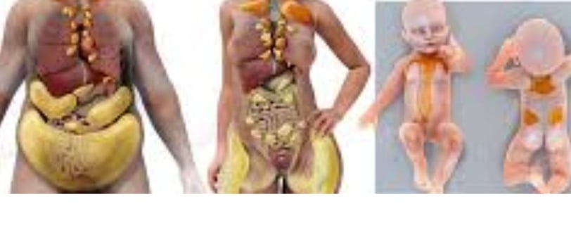 Brown Fat: Energy, Cold, Fasting, and Diseases