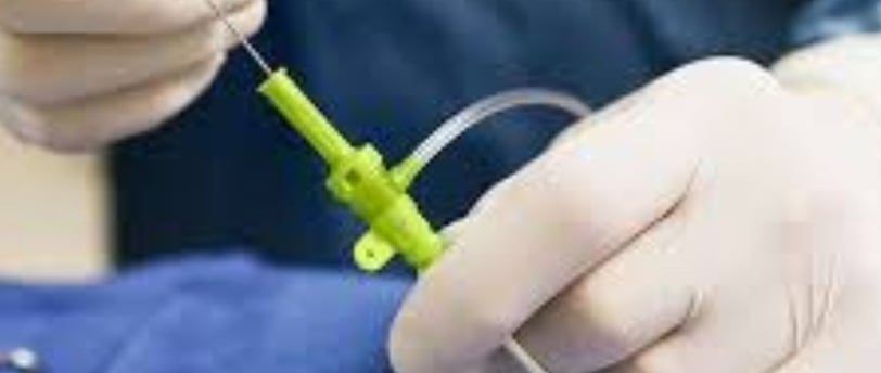 Cardiac Catheterization: Why Every Case Is Followed by a Stent