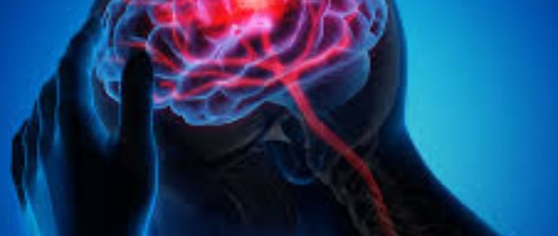 Stroke : Symptoms, Causes, Treatments, Guidelines and My Point of View