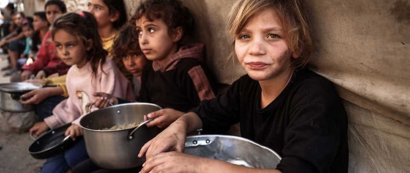 alnourished child in Gaza amidst worsening famine crisis. Starvation continues to impact Gaza’s youn