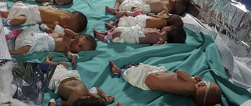 Infants suffering from starvation in Gaza