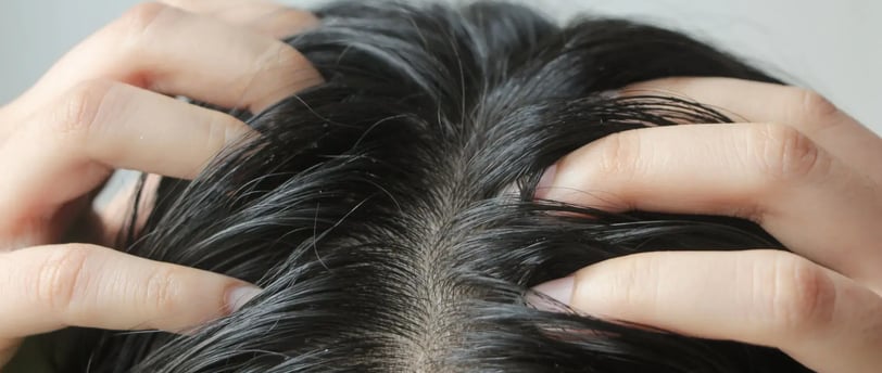 Top Sulfate-Free Shampoos for Itchy Scalps