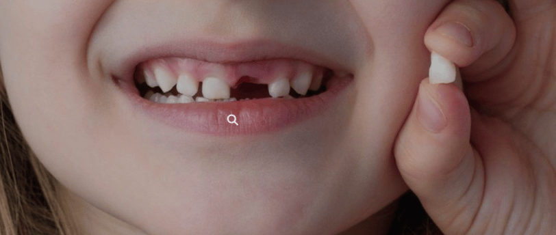 dientes de leche
