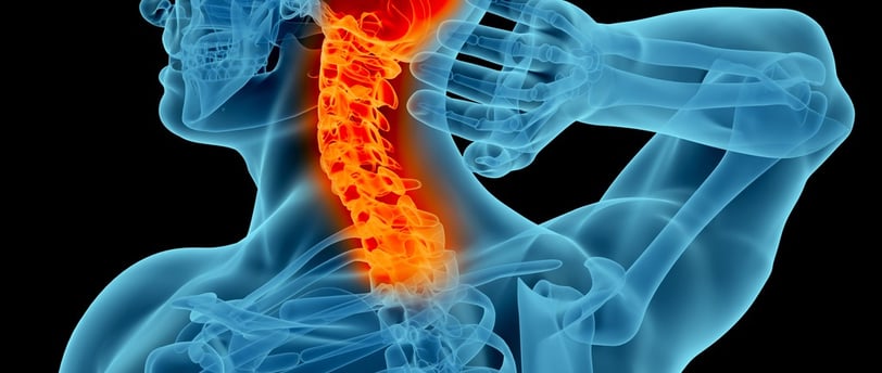 kansas city whiplash chiropractor