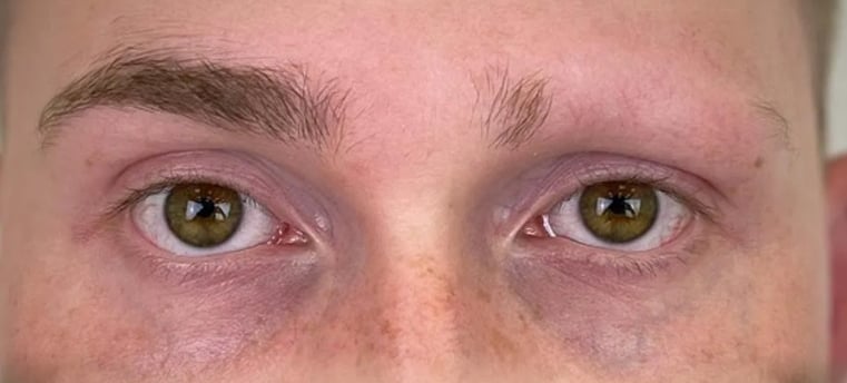 Powder Brows bei Alopezie: Wiederherstellung Ihrer Augenbrauen