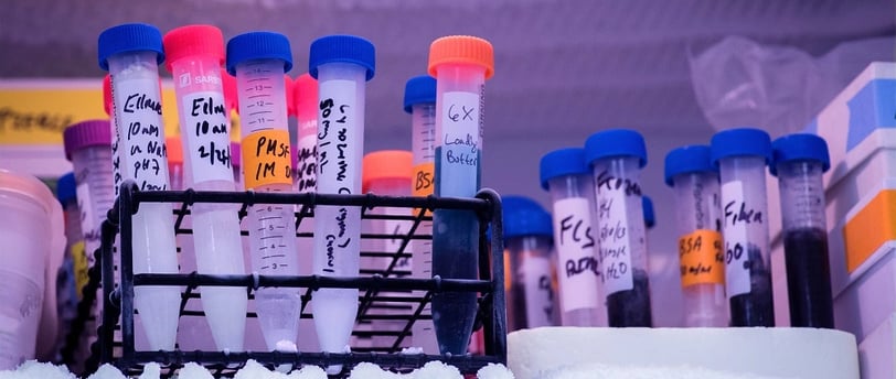 -80 freezer maintenance, regular freezer maintenance, importance of maintenance, -80 freezer reliabi