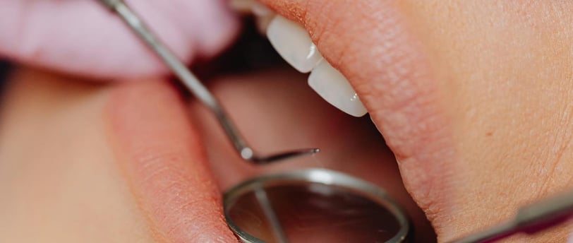 Your first dental visit