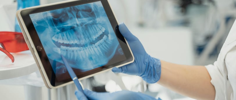 dental x-rays