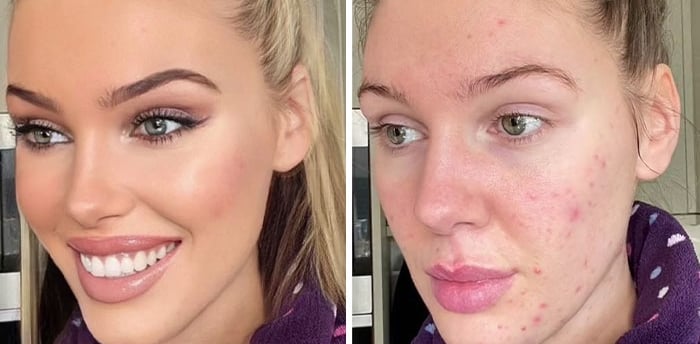 TikTok Video Goes Viral for Calling Out Unrealistic Filters “...and this is my face in real life.” D