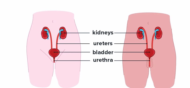 bladder infection