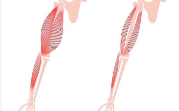 Muscular dystrophy
