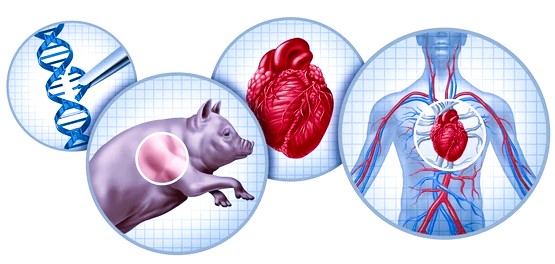 Heart Transplants