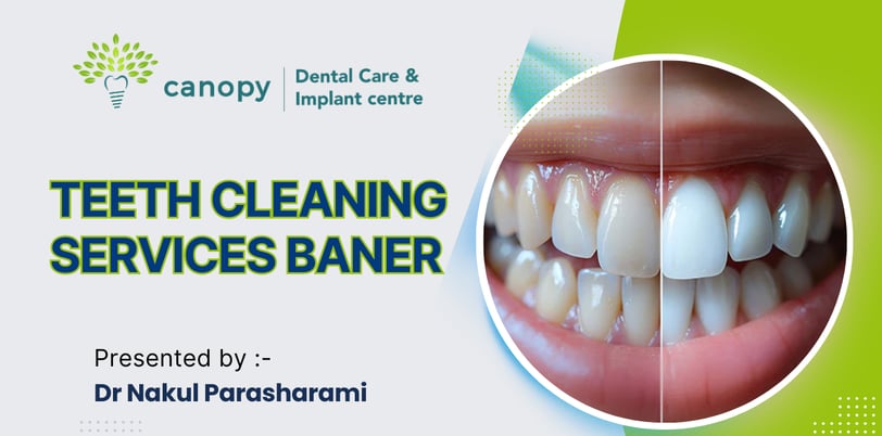 teeth cleaning services in baner