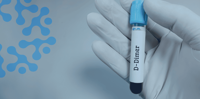 D-Dimer Testi Nedir? Pıhtılaşma Bozuklukları İçin Kullanımı