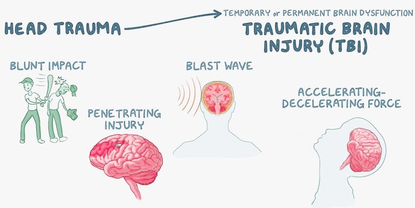 traumatic brain injury