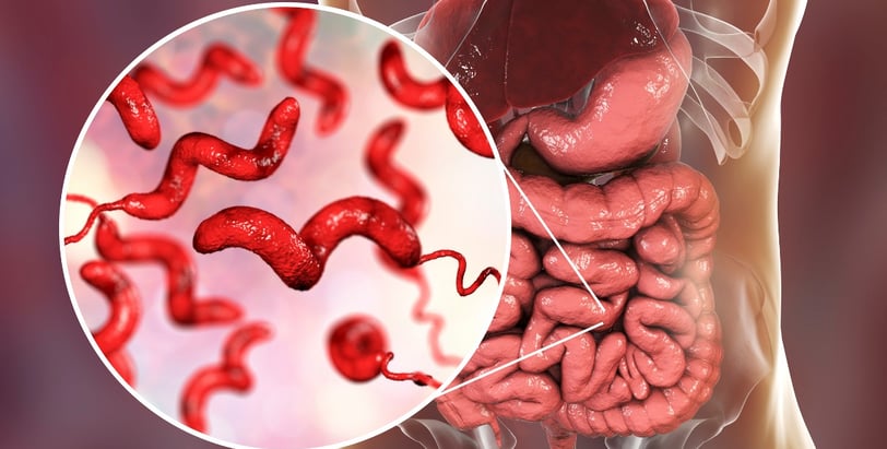 Campylobacter Infection