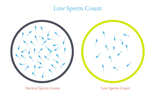 Sperm Futility Calculation