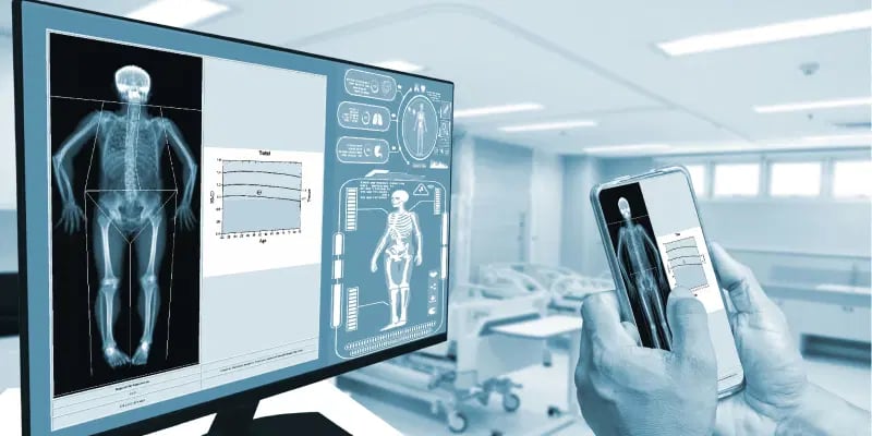 Best X Ray machines