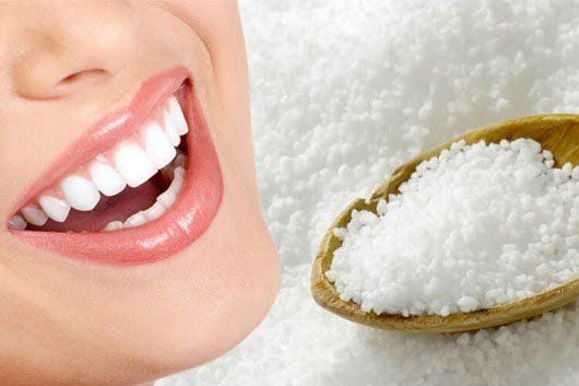 tẩy trắng răng tại nhà