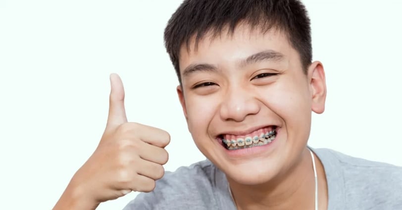 độ tuổi niềng răng cho trẻ em