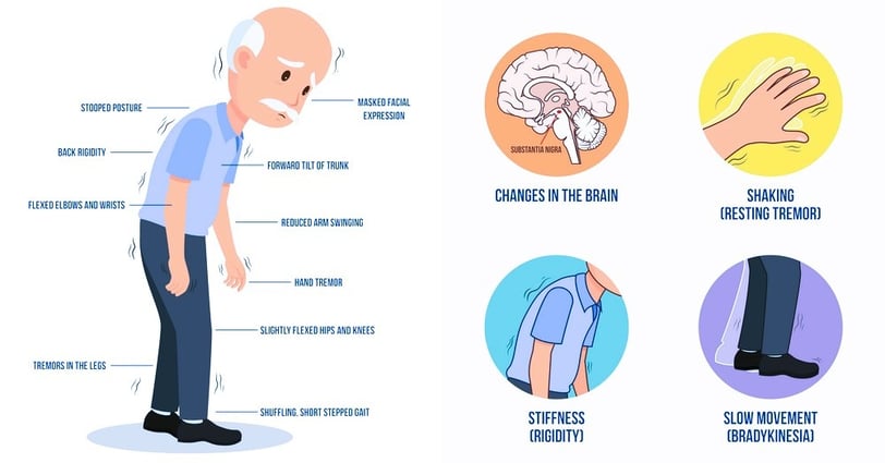 Parkinsons Disease