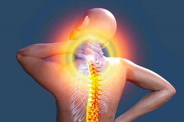 fibromyalgia
