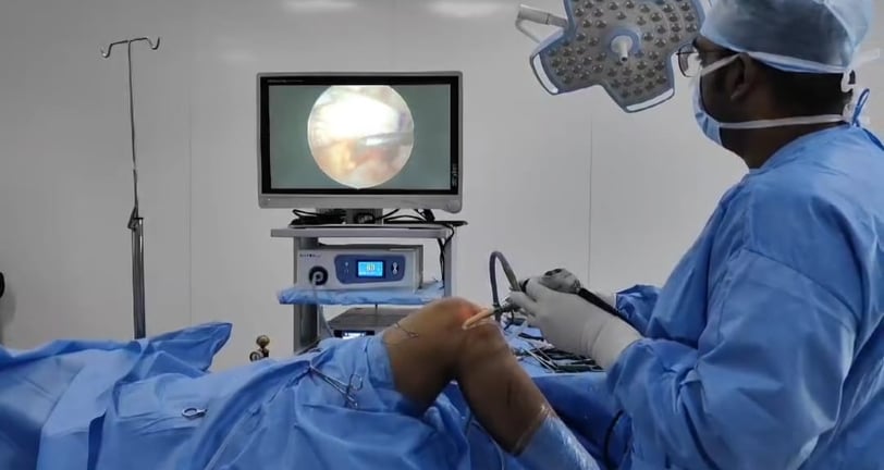 Dr Vijay Chandar performing minimally invasive arthroscopic surgery on a patient's knee