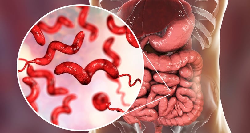 Campylobacter infection