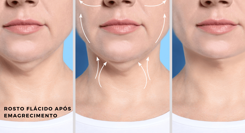 a woman with a facelift and a noseplant