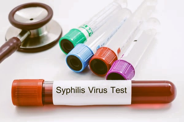 syphilis