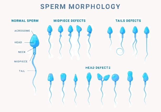 sperm