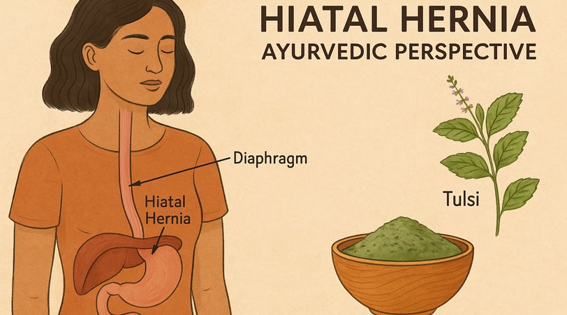 Ilustración de una mujer con sistema digestivo resaltado, mostrando una hernia de hiato desde el enfoque ayurvédico, acompaña