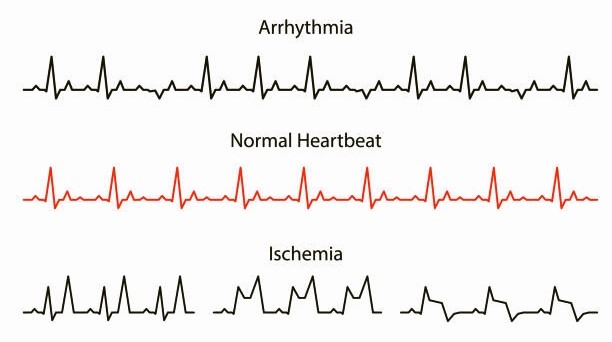 Heart Rate