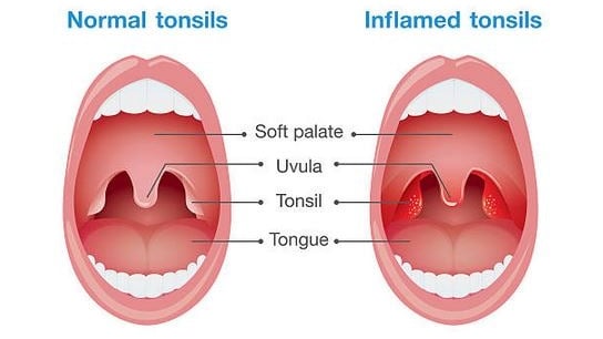 Tonsils