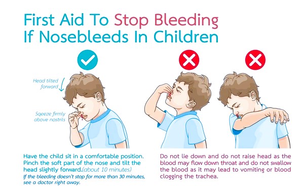 nosebleeds