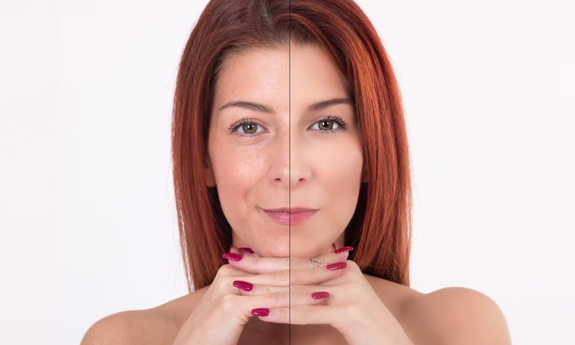 Before and after skincare treatment on redhead woman.