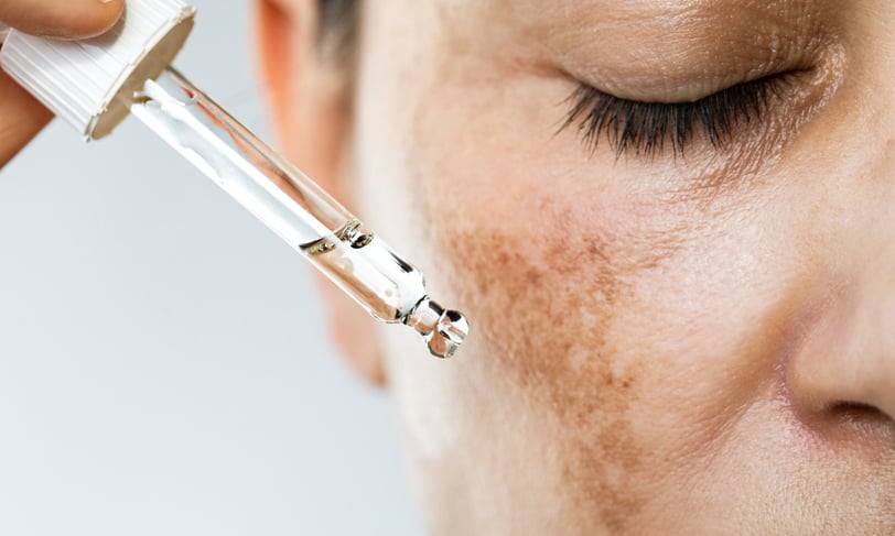 Woman applying serum to reduce hyperpigmentation and improve skin texture.
