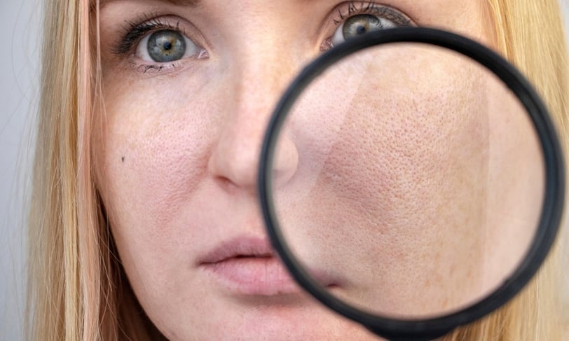 Close-up of large skin pores magnified.