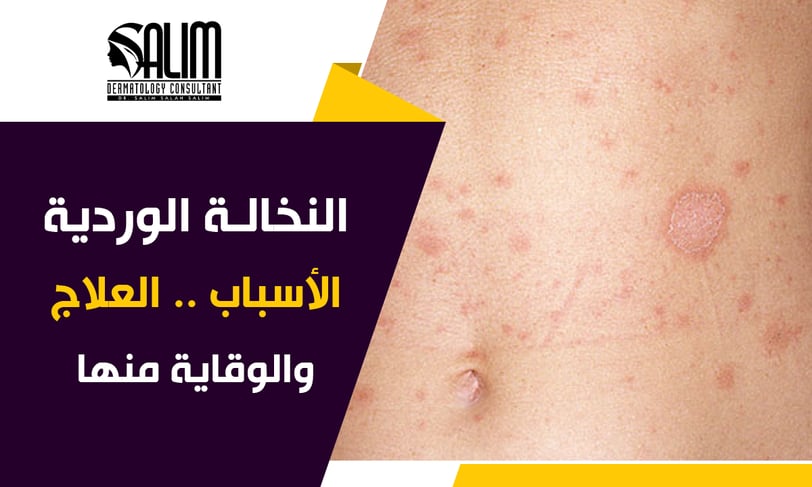 a person with a large amount of red scaly patches on his body