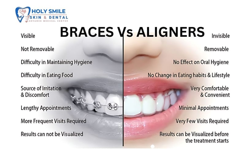 Braces vs aligners which on is best kolkata
