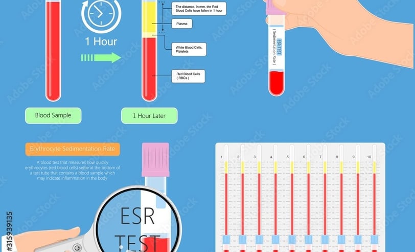 Erythrocyte Sedimentation Rate