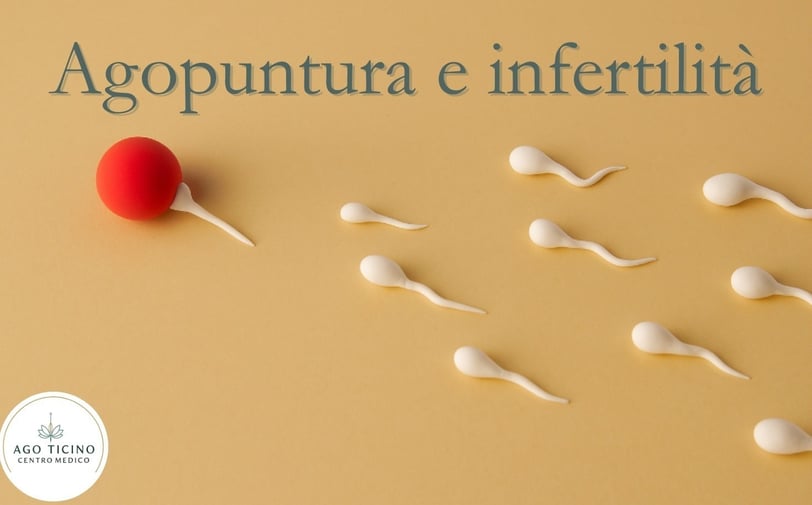 agopuntura-infertilità-fivet